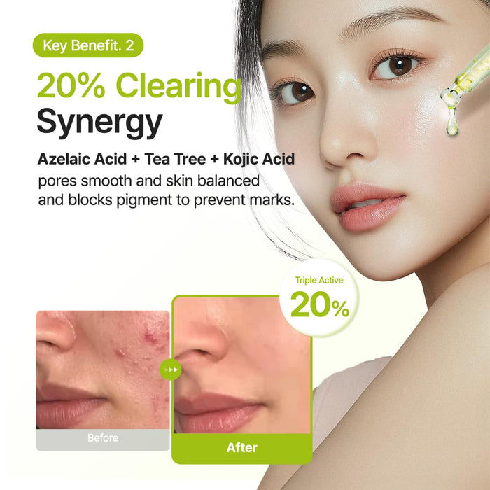 Purito Azelaic Acid 10 Kojic Tea Tree Serum (30ml)